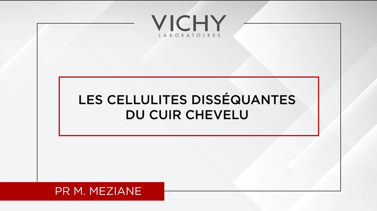 Les cellules disséquantes du cuir chevelu par Pr M. MEZIANE