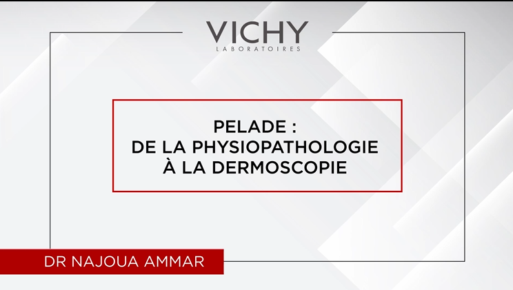 Pelade : De La physiopathologie à la démoscopie par Dr N. AMMAR