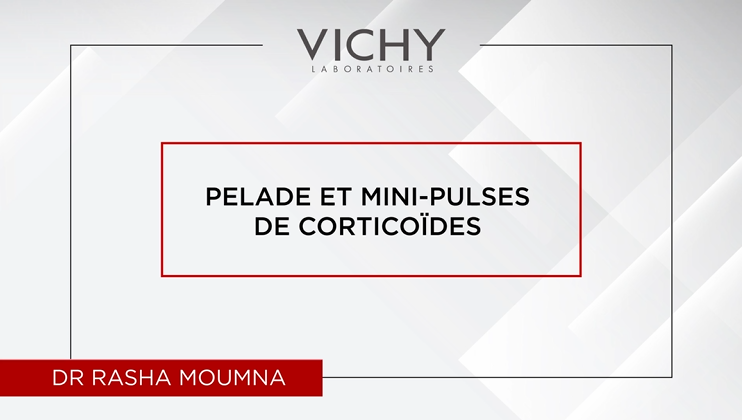 Pelade et mini pulses de corticoïdes par Dr R. MOUMNA